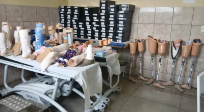 AMAG distribui próteses para pacientes no SUS.
