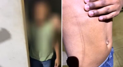 Criança apresenta sinais de agressão.
